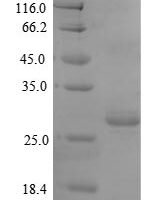 Mouse Thrombospondin-2 (Thbs2), partial Recombinant Protein - BioCrest Sci