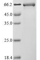 Human Fibrinogen-like protein 1 (FGL1) Recombinant Protein - BioCrest Sci