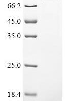 Human DNA polymerase theta (POLQ), partial Recombinant Protein, C-His - BioCrest Sci