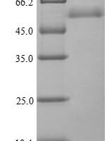 Chironex fleckeri Toxin CfTx-1, partial Recombinant Protein - BioCrest Sci