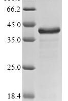 Staphylococcus aureus Glycyl-glycine endopeptidase lytM (lytM) Recombinant Protein - BioCrest Sci