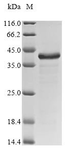 Staphylococcus aureus Glycyl-glycine endopeptidase lytM (lytM) Recombinant Protein, Staphylococcus aureus (strain NCTC 8325), E.coli, N-terminal 6xHis-tagged, 35.9 kDa, purity >≥ 85% as determined by SDS-PAGE.