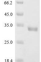 Staphylococcus aureus Alpha-hemolysin (hly) Recombinant Protein, Tag-Free - BioCrest Sci