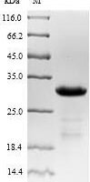 Mouse Neuropeptide Y receptor type 2 (Npy2r), partial Recombinant Protein, N-10His-SUMO/C-Myc - BioCrest Sci