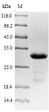 Mouse Neuropeptide Y receptor type 2 (Npy2r), partial Recombinant Protein, N-10His-SUMO/C-Myc, Mus musculus (Mouse), E.coli, N-terminal 10xHis-SUMO-tagged and C-terminal Myc-tagged, 25.5 kDa, purity >≥ 85% as determined by SDS-PAGE.