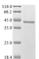 Mouse Alpha-2-macroglobulin receptor-associated protein (Lrpap1), partial Recombinant Protein, N-GFP - BioCrest Sci