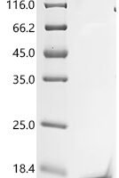Bovine Insulin-like growth factor I (IGF1) Recombinant Protein, C-His, aa 50–119, E.coli - BioCrest Sci