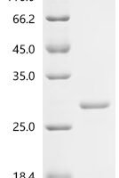 Mouse Macrophage colony-stimulating factor 1 (Csf1), partial Recombinant Protein, C-His, aa 33–187, E.coli - BioCrest Sci