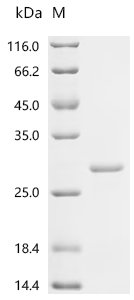 Mouse Macrophage colony-stimulating factor 1 (Csf1), partial Recombinant Protein, C-His, aa 33–187, E.coli, Mus musculus (Mouse), E.coli, C-terminal 6xHis-tagged, 25.0 kDa, purity >≥ 85% as determined by SDS-PAGE.