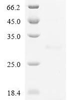 Human Bone morphogenetic protein 2 (BMP2) Recombinant Protein, N-10His-CBD - BioCrest Sci