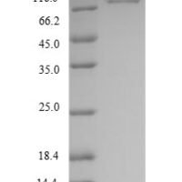 Human Heterogeneous nuclear ribonucleoprotein K (HNRNPK), partial Recombinant Protein, N-GST - BioCrest Sci