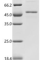 Human Follicle-stimulating hormone receptor (FSHR), partial Recombinant Protein, C-His - BioCrest Sci