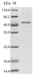 Human Follicle-stimulating hormone receptor (FSHR), partial Recombinant Protein, C-His, Homo sapiens (Human), E.coli, C-terminal 6xHis-tagged, 46.8 kDa, purity >≥ 90% as determined by SDS-PAGE.