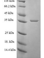 Human Proactivator polypeptide (PSAP), partial Recombinant Protein - BioCrest Sci