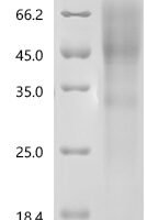 Human Microtubule-associated protein tau (MAPT) Recombinant Protein, N-10His/C-mCherry - BioCrest Sci
