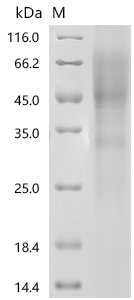 Human Microtubule-associated protein tau (MAPT) Recombinant Protein, N-10His/C-mCherry, Homo sapiens (Human), Yeast, N-terminal 10xHis-tagged and C-terminal mCherry-tagged, 74.6 kDa, purity >≥ 90% as determined by SDS-PAGE.