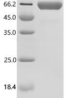 Mouse Desmoplakin (Dsp), partial Recombinant Protein, C-hFc1 - BioCrest Sci