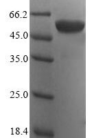 Human ATP synthase F(1) complex subunit alpha, mitochondrial (ATP5F1A) Recombinant Protein, N-His, aa 44–553, Yeast - BioCrest Sci