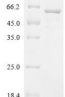 Human Dedicator of cytokinesis protein 5 (DOCK5), partial Recombinant Protein - BioCrest Sci