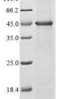 Bovine 7-dehydrocholesterol reductase (DHCR7) Recombinant Protein - BioCrest Sci