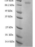 Human Keratin, type II cytoskeletal 6A (KRT6A) Recombinant Protein, N-GST - BioCrest Sci