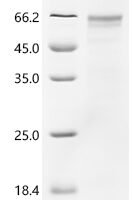 Human Lysosomal acid glucosylceramidase (GBA1 ) Recombinant Protein - BioCrest Sci