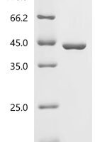 Mouse Biliverdin reductase A (Blvra) Recombinant Protein, C-His, aa 3–295, E.coli - BioCrest Sci