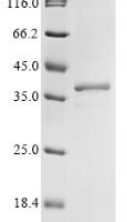 Mouse 40S ribosomal protein S3 (RPS3) Recombinant Protein - BioCrest Sci