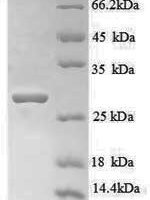 Human Titin (TTN), partial Recombinant Protein, N-His - BioCrest Sci