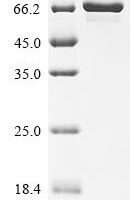 Plasmodium falciparum Apical membrane antigen 1, partial, Biotinylated Recombinant Protein - BioCrest Sci