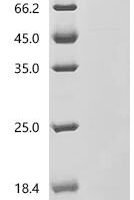 Woodchuck hepatitis B virus Protein X (X), partial Recombinant Protein - BioCrest Sci