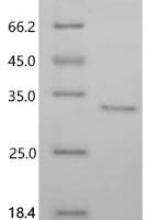 Yersinia pestis DNA-binding protein Recombinant Protein - BioCrest Sci
