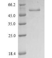 Human Vimentin (VIM) Recombinant Protein, N-His, aa 2–466, Yeast - BioCrest Sci