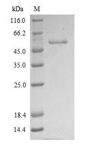 Human Vimentin (VIM) Recombinant Protein, N-His, aa 2–466, Yeast, Homo sapiens (Human), Yeast, N-terminal 6xHis-tagged, 55.5 kDa, purity >≥ 90% as determined by SDS-PAGE.