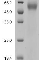 Mouse Napsin-A (Napsa) Recombinant Protein - BioCrest Sci