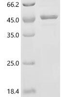 Human Ferroptosis suppressor protein 1 (AIFM2), partial Recombinant Protein - BioCrest Sci