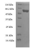 Human 39S ribosomal protein L19, mitochondrial (MRPL19) Recombinant Protein - BioCrest Sci