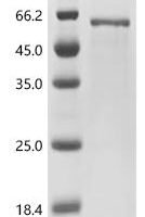 Baboon endogenous virus Envelope glycoprotein (env), partial Recombinant Protein - BioCrest Sci