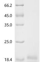 Human T-cell surface glycoprotein CD3 epsilon chain (CD3E), partial Recombinant Protein - BioCrest Sci