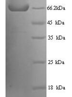 Human Receptor-type tyrosine-protein phosphatase N2 (PTPRN2), partial Recombinant Protein - BioCrest Sci