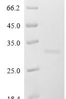 Human Bcl-2-like protein 11 (BCL2L11) Recombinant Protein, N-NEXT/C-10His - BioCrest Sci