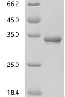 Rat Apolipoprotein A-I (Apoa1), partial Recombinant Protein, C-His - BioCrest Sci