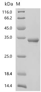 Rat Apolipoprotein A-I (Apoa1), partial Recombinant Protein, C-His, Rattus norvegicus (Rat), E.coli, C-terminal 6xHis-tagged, 34.3 kDa, purity >≥ 95% as determined by SDS-PAGE.