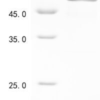 Human Complement C1q tumor necrosis factor-related protein 1 (C1QTNF1) Recombinant Protein, N-GST - BioCrest Sci