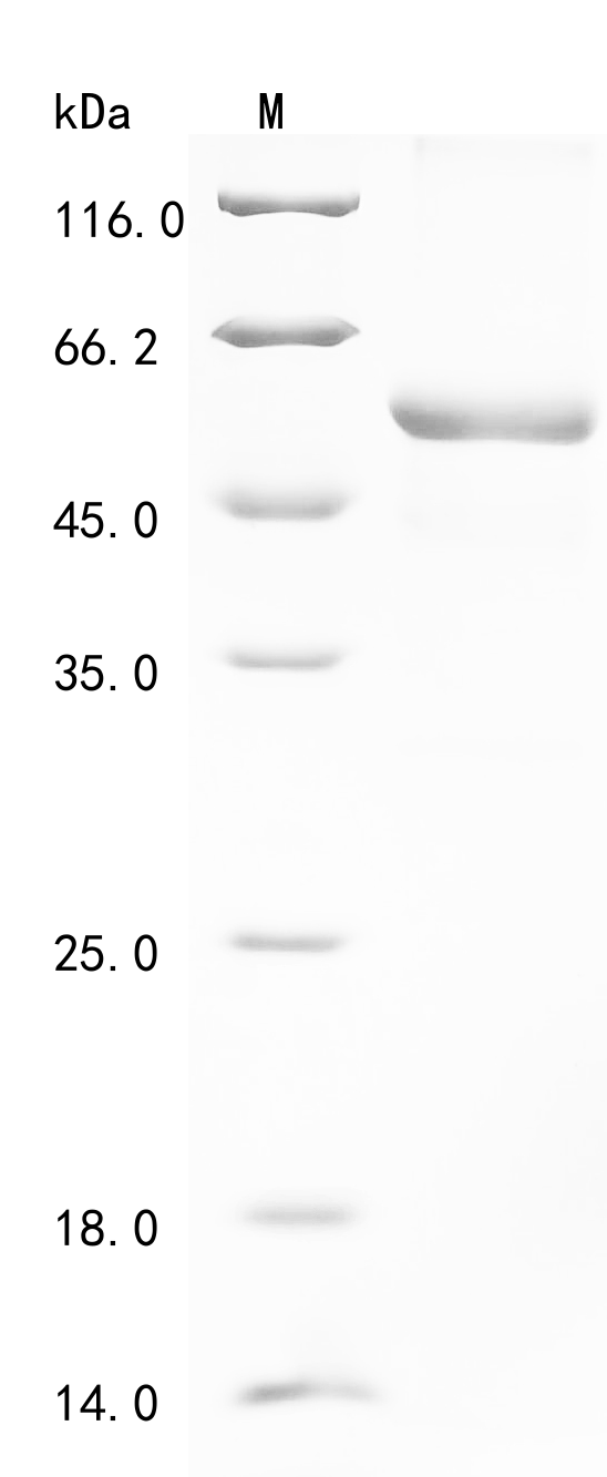 Human Complement C1q tumor necrosis factor-related protein 1 (C1QTNF1) Recombinant Protein, N-GST, Homo sapiens (Human), E.coli, N-terminal GST-tagged, 56.7 kDa, purity >≥ 85% as determined by SDS-PAGE.