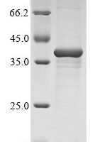 Bovine Nucleotide-binding oligomerization domain-containing protein 2 (NOD2), partial Recombinant Protein - BioCrest Sci