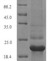 Hepatitis C virus genotype 1b Genome polyprotein, partial Recombinant Protein, N-His, aa 2–177 - BioCrest Sci