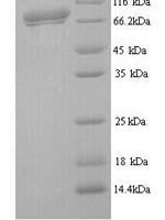 Influenza C virus Hemagglutinin-esterase-fusion glycoprotein (HE), partial Recombinant Protein - BioCrest Sci