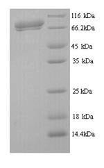 Influenza C virus Hemagglutinin-esterase-fusion glycoprotein (HE), partial Recombinant Protein, Influenza C virus (strain C/California/1978), Yeast, N-terminal 6xHis-tagged, 70.1 kDa, purity >≥ 90% as determined by SDS-PAGE.