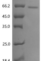Sindbis virus Non-structural polyprotein, partial Recombinant Protein, C-His - BioCrest Sci